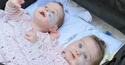 NI parents share first photo of formerly conjoined twins after successful separation surgery