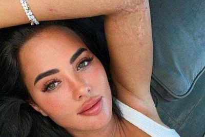 Yazmin Oukhellou shows scar on arm for first time from car crash that killed on-off boyfriend Jake McLean
