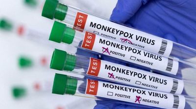 Monkeypox Mostly Spreads before Symptoms Appear, Study Suggests