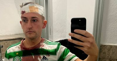 Battered Celtic fan left needing staples in head after 'unprovoked attack' from Spanish cops