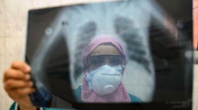 UK Researchers Cure Man Who Had Covid for 411 Days