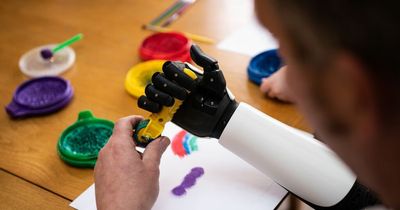 Bionic arms that mimic hand movements to be made available on NHS