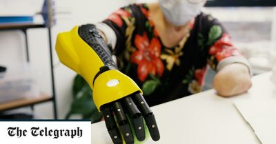 Brain-controlled bionic arms to be offered to amputees on NHS