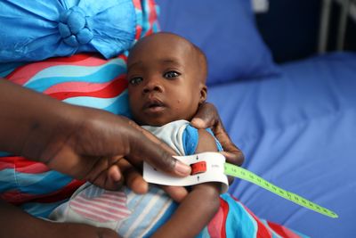 Malnutrition woes overwhelm children in northeast Nigeria