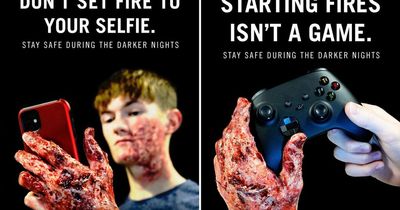 Top paramedic warns burns are among the 'most devastating' injuries he sees in Bonfire Night safety warning