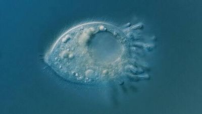 114 years ago, this super-rare microorganism was discovered — only four people have seen it since