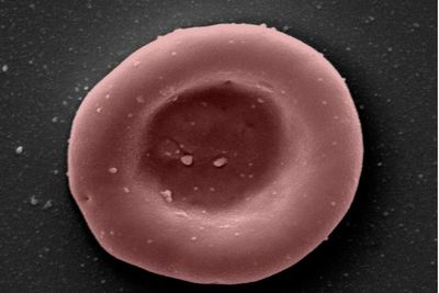 ‘Lab-grown red blood cells transfused in to person in a world first’