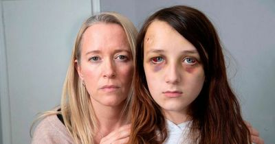 Glasgow teenager may never return to school after she was ‘lured to park and beaten unconscious’