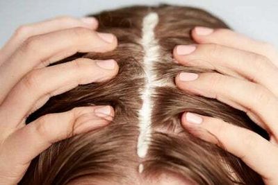 Best hair products and treatments to help with dry, itchy scalps