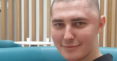 'Fit and healthy' man was days away from slipping into coma after constant headaches