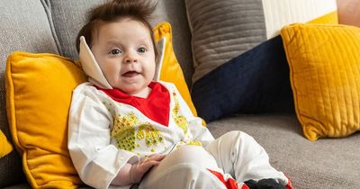 Baby born with so much thick, dark hair strangers think she looks like Elvis