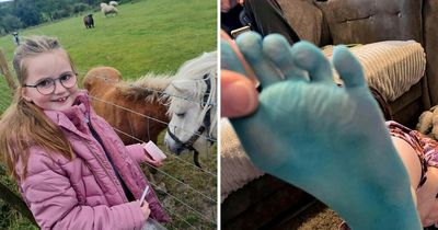 Schoolgirl, 9, feeling blue after food colouring mishap left her 'looking like a Smurf'