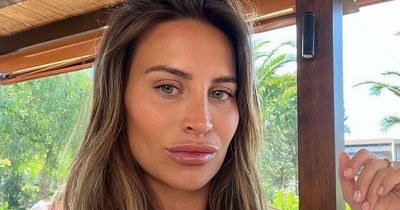 Ferne McCann accused of 'disgusting' comments over ex-boyfriend's acid attack victims