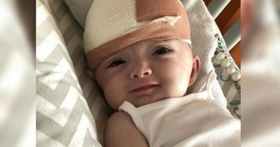 Baby's skull was removed and 'put back together like jigsaw puzzle'