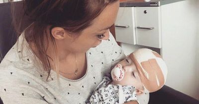 Doctors insist baby born with 'sideways head' is fine but mum's instinct proved right