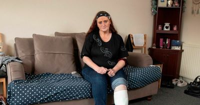 Horror dog attack victim begs medics to amputate her leg