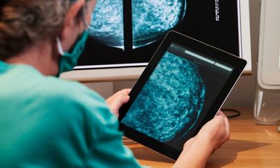 Advising older patients against breast cancer surgery is ‘age bias’, UK study finds