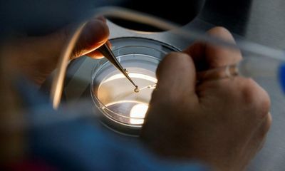 Share your experience of egg freezing in the UK