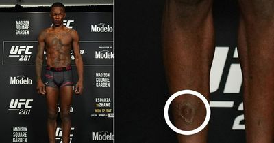 UFC fans fear Israel Adesanya has picked up infection ahead of title fight