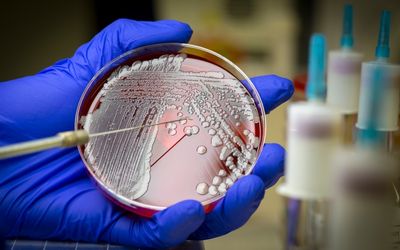 New antibiotic: Successful clinical trial for ‘superbug’ killer
