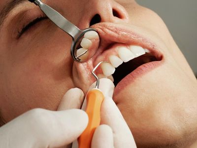 Dentists Say Patients Are Showing Up Stoned - ADA Is Not Pleased And For Good Reason
