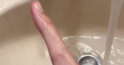 Man with giant thumb goes viral because he'll 'never lose a thumb war'