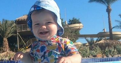 Baby needs to have 'skull removed' to ease pressure on his brain