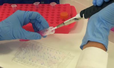 Europe faces ‘cancer epidemic’ after estimated 1m cases missed during Covid