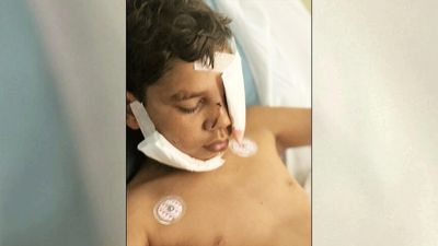 Police dog bite sparks outrage as 13-year-old WA boy Jayden Abraham suffers severe injuries