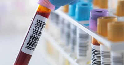 Blood test could detect breast cancer up to two years earlier, study suggests