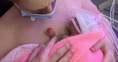 World Prematurity Day: Family of baby born without heartbeat celebrates first birthday