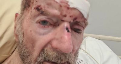 Man, 85, has 'fingers bitten to bone' in brutal hour long attack at care home