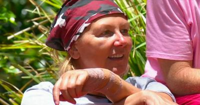 I'm A Celebrity fans concerned after spotting bandage on Sue Cleaver's hand