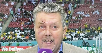RTE's George Hamilton sports black eye as he reports live from World Cup opener in Qatar