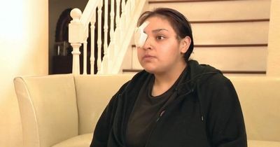 Hero fast-food worker loses eye after trying to stop man bullying special needs boy