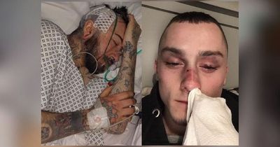 'This has absolutely destroyed me': The men beaten up for being gay