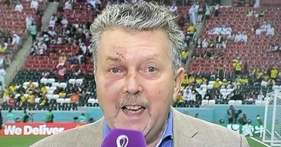 RTE commentator George Hamilton leaves World Cup viewers concerned as he sports black eye on live TV