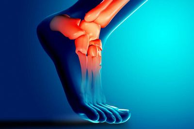 Ruptured Achilles tendon will take time to heal
