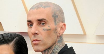 Travis Barker breaks toe and is fitted with boot following birthday celebrations