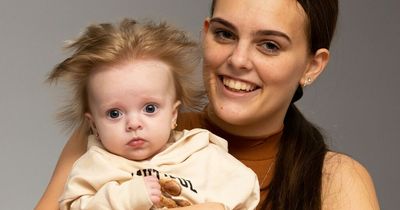 Baby with 'crazy' hair compared to dandelion - but her mum never wants it to go 'normal'