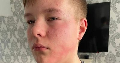 Boy left with swollen face after being 'punched by grown man' at pal's house