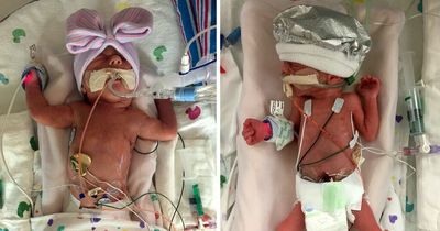 Twin baby 'sent out distress signal' in womb and saved poorly sister's life