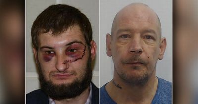 Victim's horrendous injuries after crack addict slashed his face with Stanley knife while shouting 'I'll kill you'