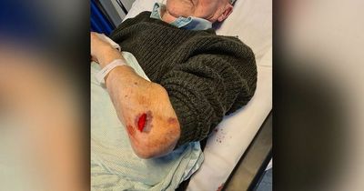 Pensioner's arm gashed during nightmare A&E wait lasting almost 12 hours