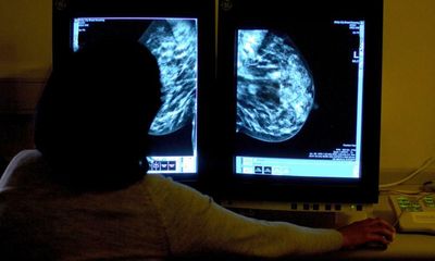 Poorer women in UK have sixth-highest cancer death rates in Europe, WHO finds