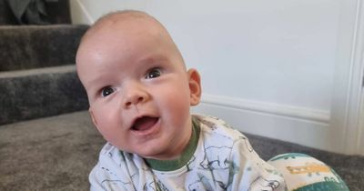 Boy, 1, is 'ticking time bomb' waiting for skull to be removed due to rare defect