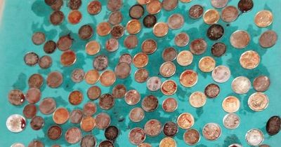 Doctors discover 187 coins in man's stomach after he complained he was 'bloated'