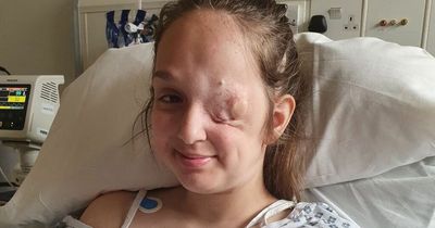 Schoolgirl dies from rare cancer despite being given all clear after eye removed
