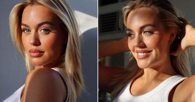 Lottie Tomlinson debuts natural face after dissolving fillers in 'best decision ever'