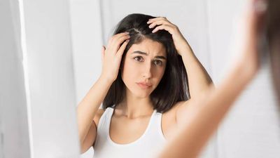 Does oiling hair increase dandruff?